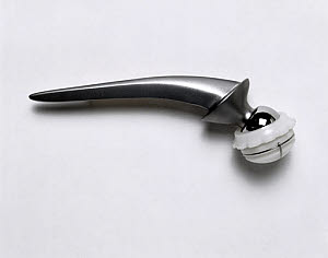 10327204
� Science Museum
'Exeter' plastic hip joint, 1985.