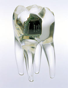 10328750
� Science Museum
Audio tooth implant, 2002.