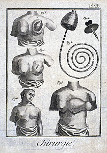 10315163
� Science Museum Pictorial
Mastectomy prosthetic, 1780.