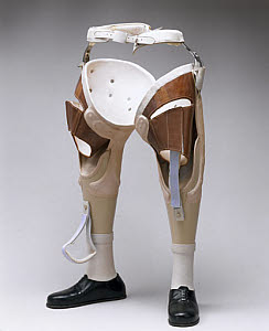 10406289
� Science Museum
Pair of non-articulated metal legs for a male Thalidomide teenager, 1975.