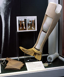 10278951
&copy; Science Museum
Orthopaedic display, Science Museum, London, 1985.