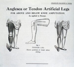 10326523
&copy; Science Museum
'Anglesea or Tendon Artificial Legs', 1920-1930.