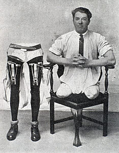 10326525
&copy; Science Museum
Man with amputated legs sitting beside a set of artificial legs, 1920-1930.