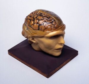 10306351
&copy; Science Museum
Wax anatomical model of a human head, possibly German, 19th century.