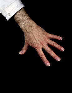 10254867
© Science Museum
Back of human hand, 1980s. 10254867
© Science Museum
Back of human hand, 1980s.