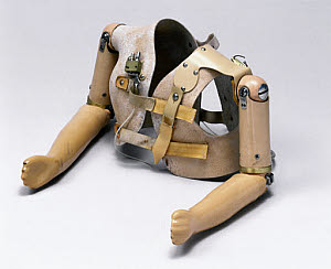 10406368
&copy; Science Museum
A pair of CO2 gas-powered artificial arms for a young child, 1963.