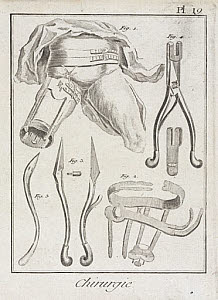 10422673
&copy; Science Museum Pictorial
Orthopaedic surgery, 1780.