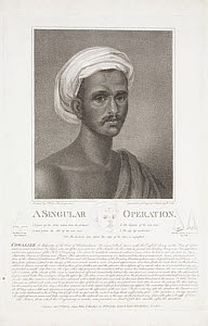 10422688
&copy; Science Museum Pictorial
'A Singular Operation', India, 1795.
