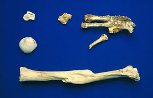 10284092
© Science Museum
Humerus of an adult human, and broken foot bones, Egyptian, 4000 BC- AD 200. 10284092
© Science Museum
Humerus of an adult human, and broken foot bones, Egyptian, 4000 BC- AD 200.