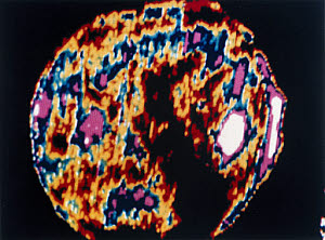 10299241
&copy; NASA
The Sun in extreme ultraviolet light, photographed by Skylab, 1973.