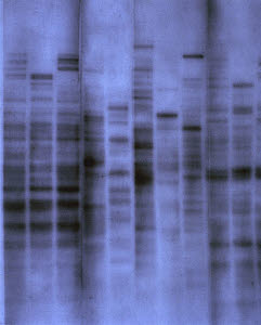 10319200
&copy; Science Museum
The first genetic fingerprint, 1984.